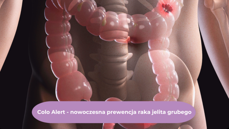 Test ColoAlert - prewencja jelita grubego