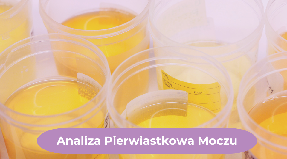 analiza minerałów w moczu